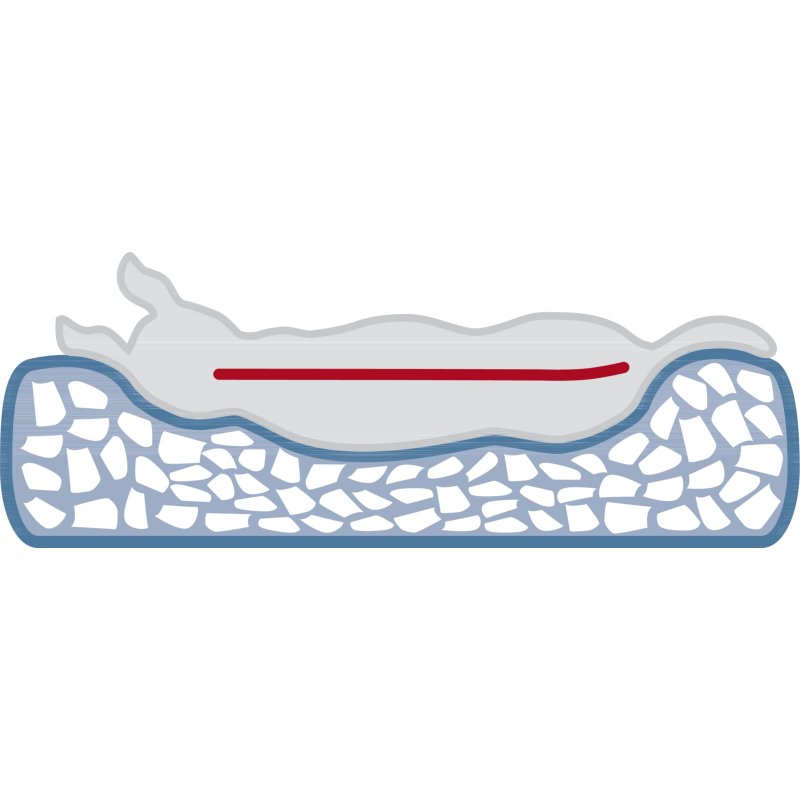 TRIXIE Vital Kissen Bendson, eckig